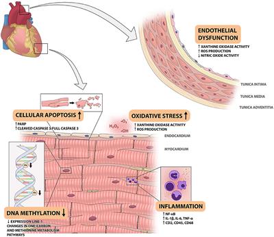 Myocardial Disease and Long-Distance Space Travel: Solving the Radiation Problem